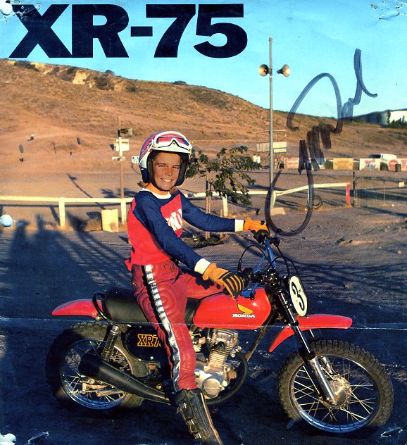 Xr 75